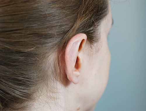 Case #718 After image