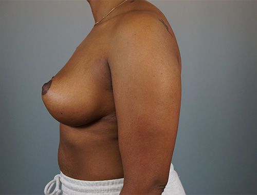 Case #711 After image