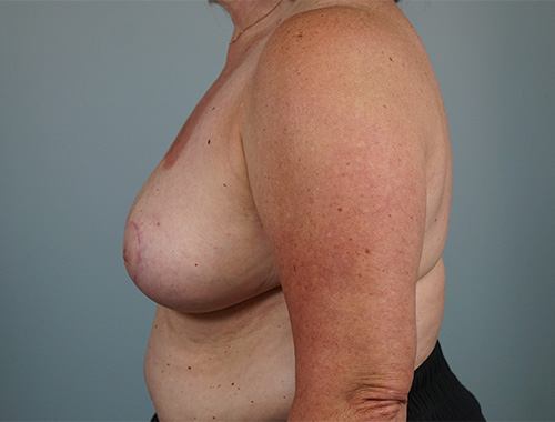 Case #712 After image