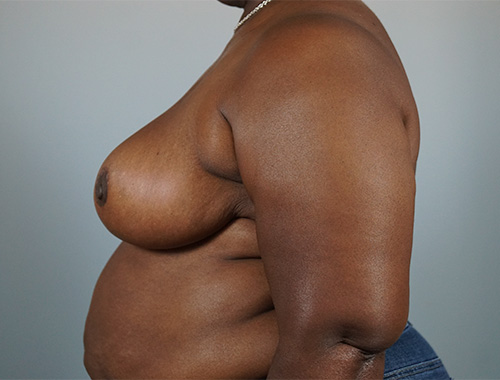 Case #716 After image