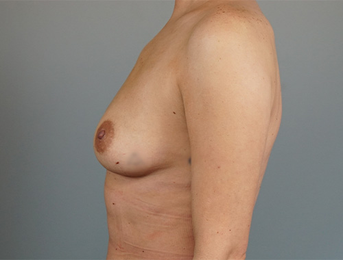 Case #710 Before image