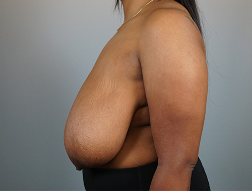 Case #711 Before image