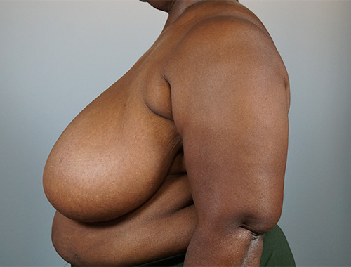 Case #716 Before image