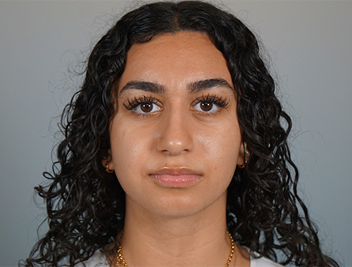 Case #721 After image