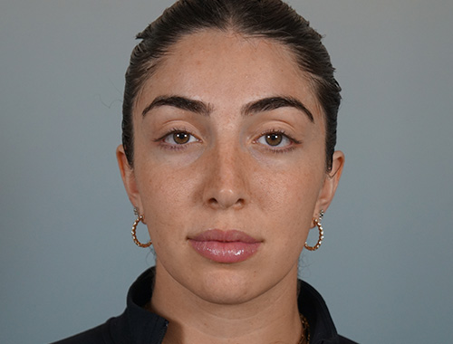 Case #722 After image