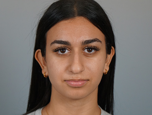 Case #721 Before image