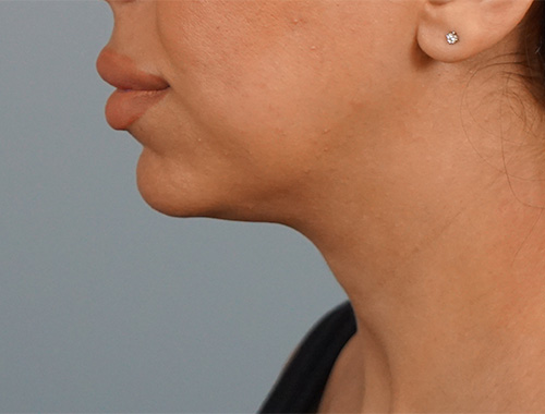 Case #723 Before image