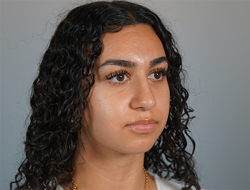 Case #721 After image