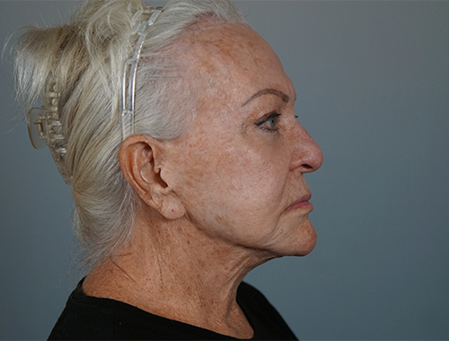 Case #720 Before image