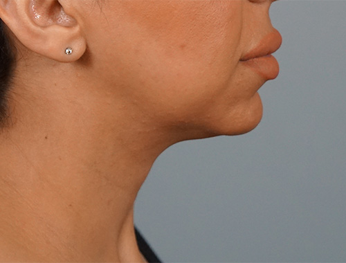 Case #723 Before image