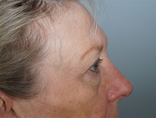 Case #719 Before image