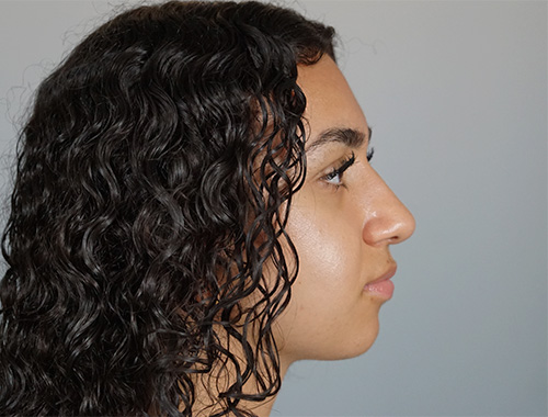 Case #721 After image