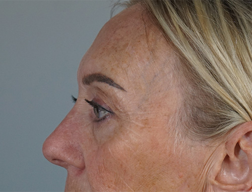 Case #719 After image