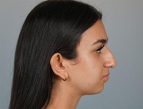 Case #721 Before image