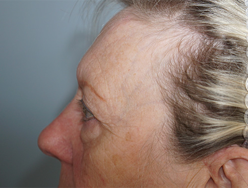 Case #719 Before image