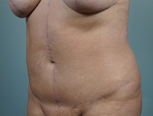 Case #727 After image