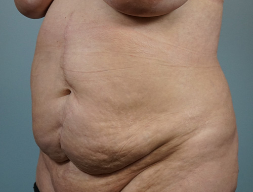 Case #727 Before image