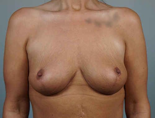 Case #730 After image