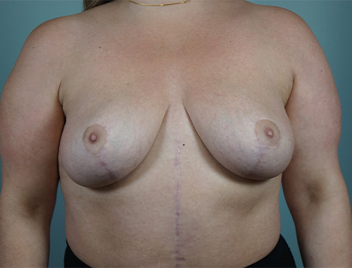 Case #731 After image