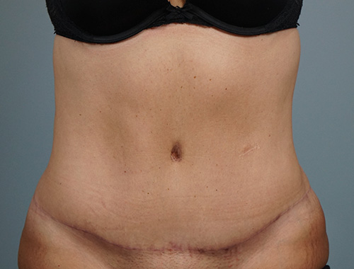 Case #733 After image