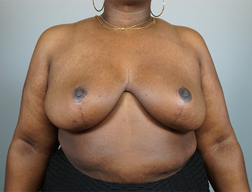 Case #729 After image