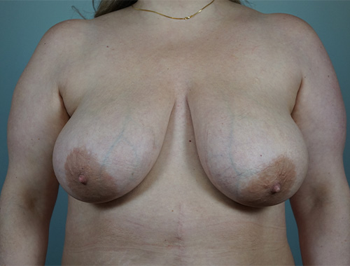 Case #731 Before image