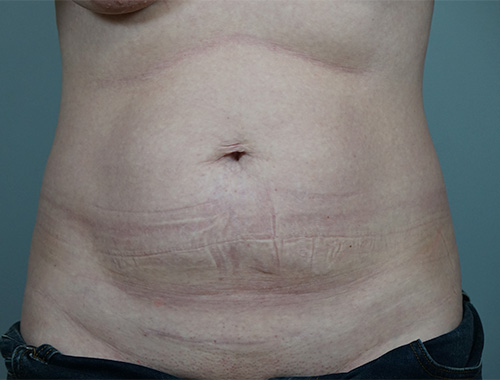 Case #732 Before image