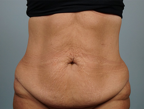 Case #733 Before image