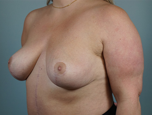 Case #731 After image