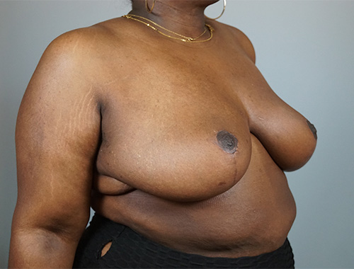 Case #729 After image