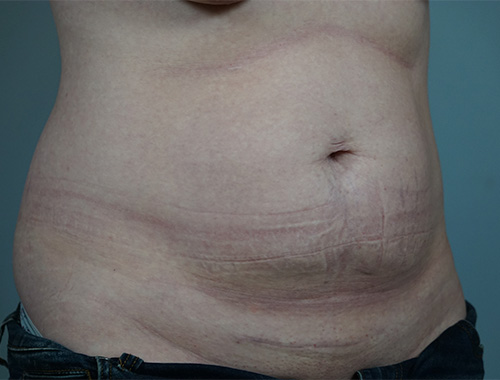 Case #732 Before image