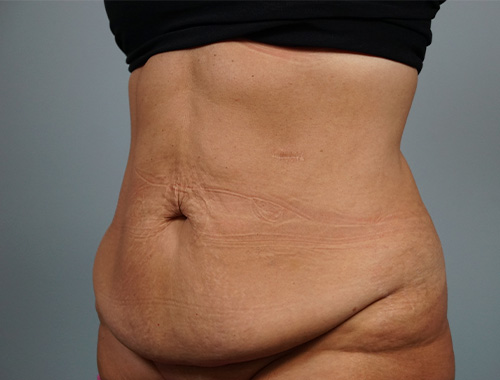 Case #733 Before image