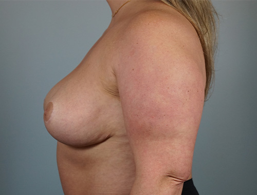 Case #731 After image