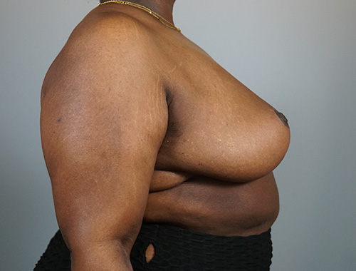 Case #729 After image