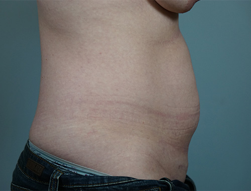 Case #732 Before image