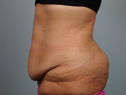 Case #733 Before image