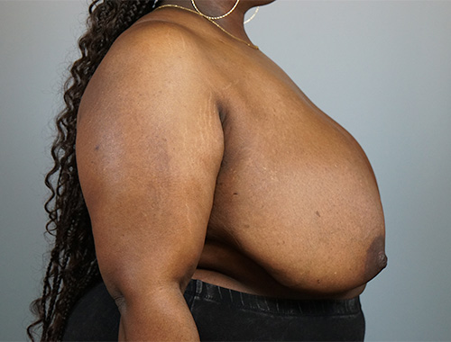 Case #729 Before image