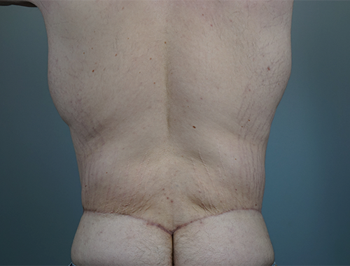 Case #738 After image