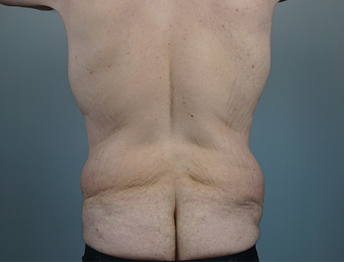 Case #738 Before image