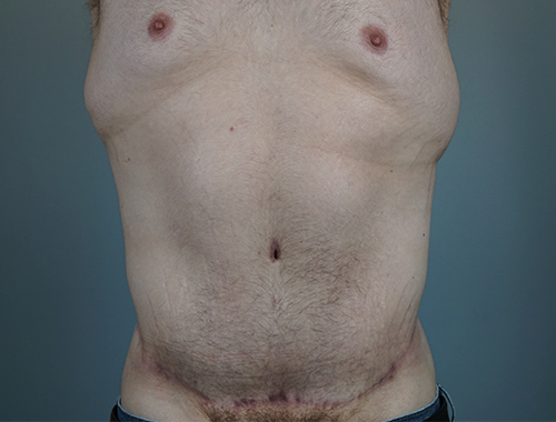 Case #738 After image