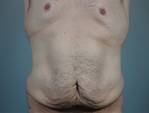 Case #738 Before image