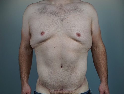 Case #738 After image