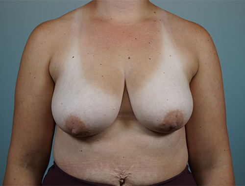 Case #735 Before image