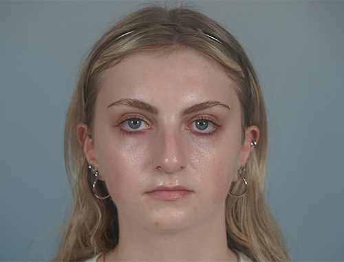 Case #736 Before image