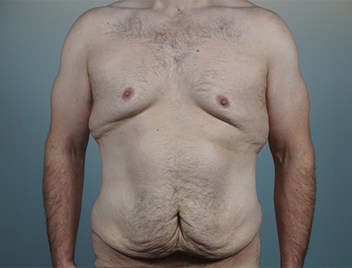 Case #738 Before image