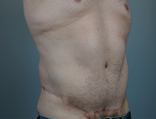 Case #738 After image