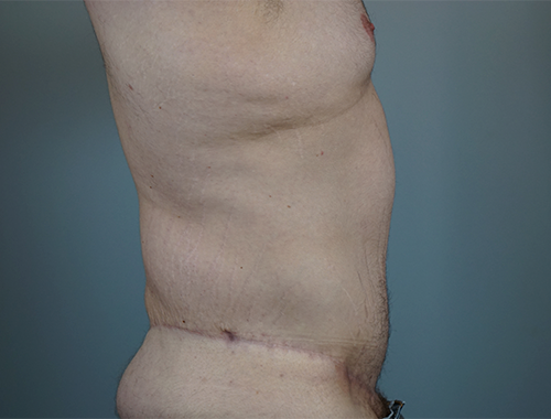 Case #738 After image