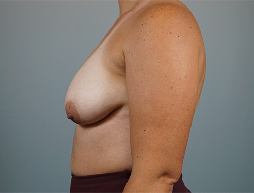 Case #735 Before image