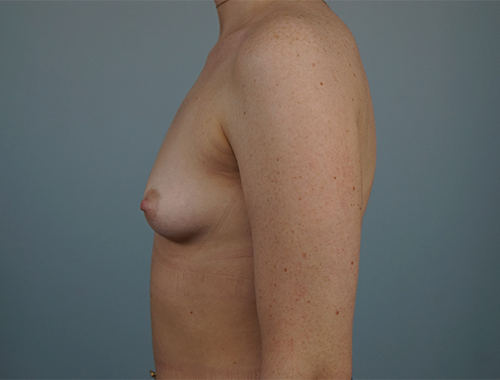Case #737 Before image