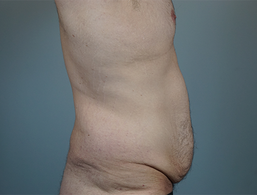 Case #738 Before image